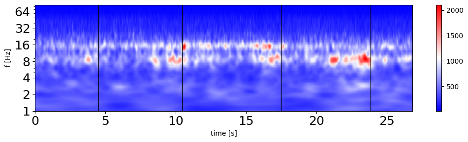 Figure2_NWB